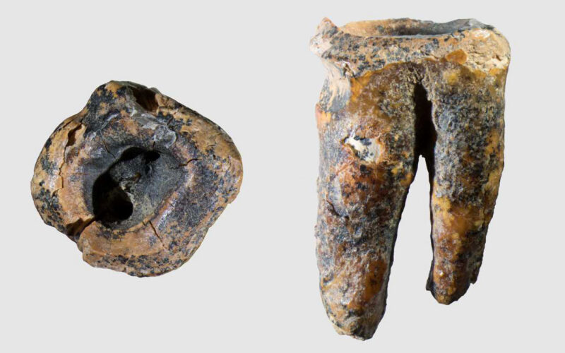 🦕 Paleo: Un molar sugiere “dentista” neandertal