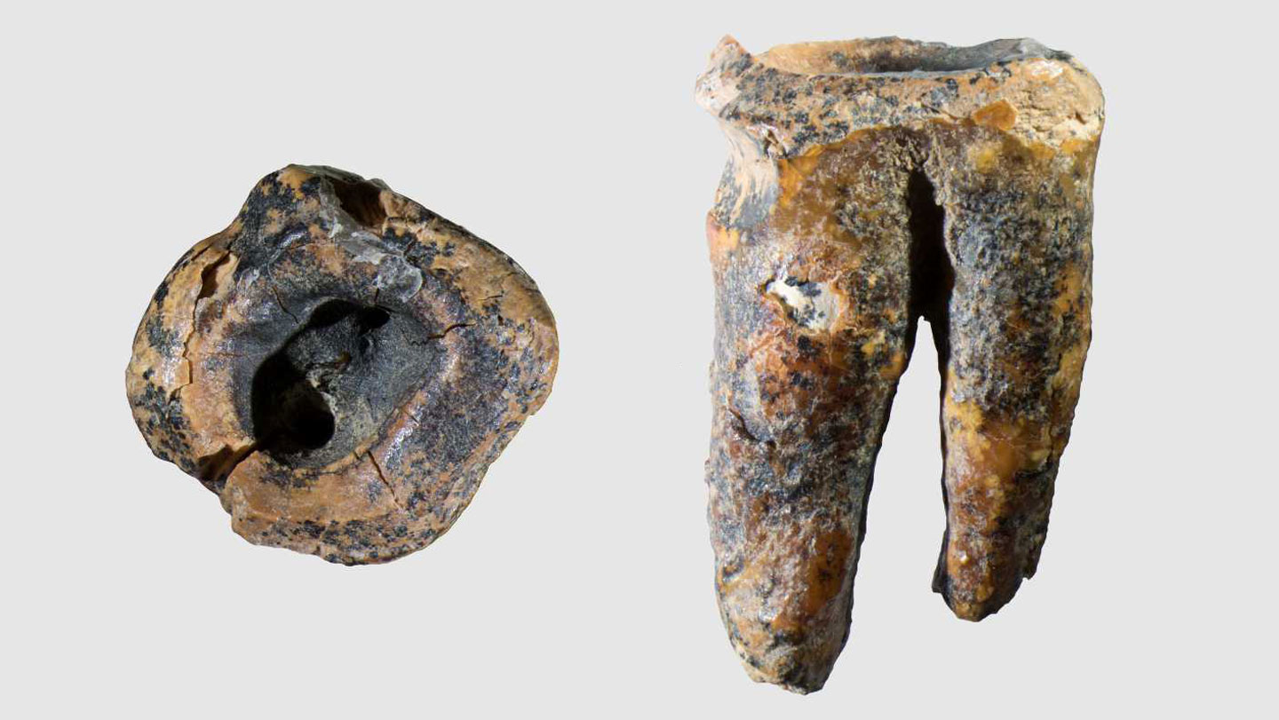 🦕 Paleo: Un molar sugiere “dentista” neandertal