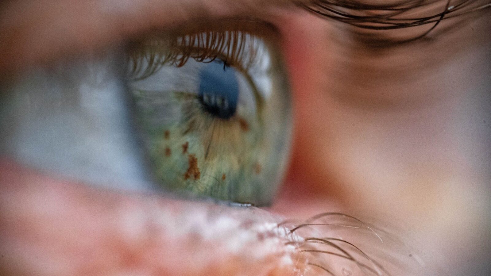 ⚕️ Salud: Detectar anemia filmando el ojo