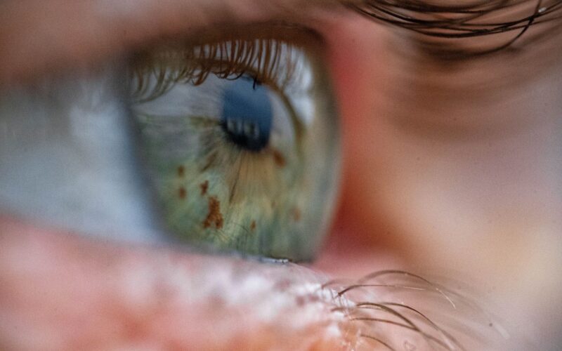 ⚕️ Salud: Detectar anemia filmando el ojo