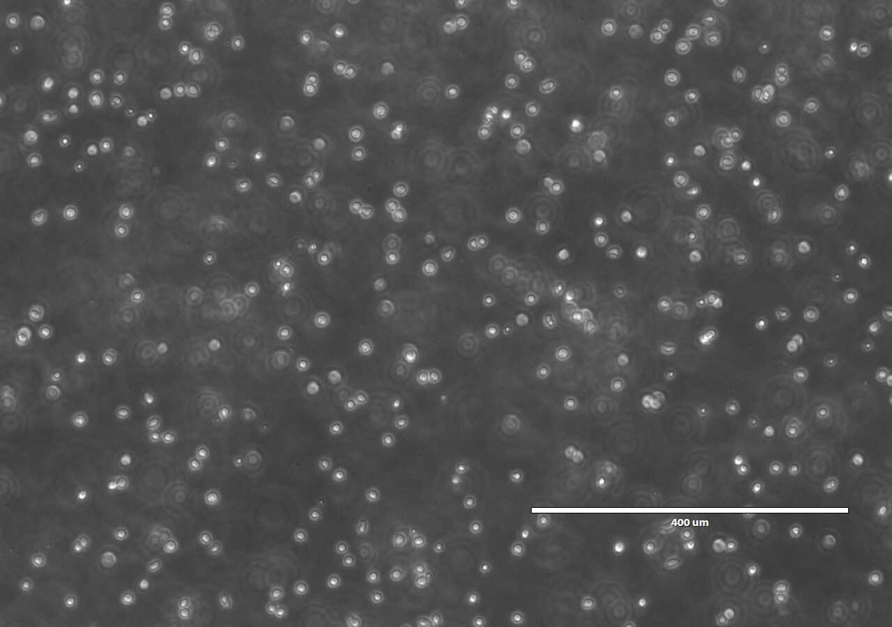 UCB CD34 cells in culture_10X.jpg