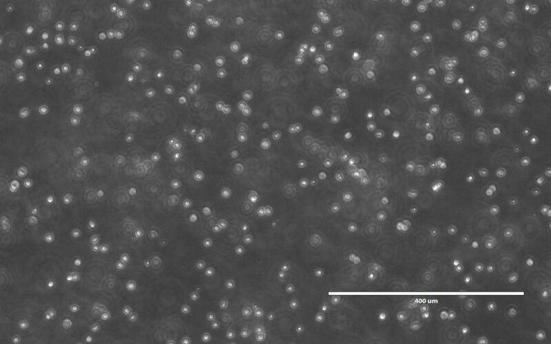 UCB CD34 cells in culture_10X.jpg