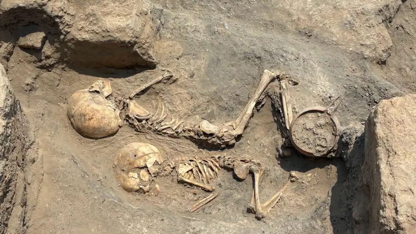 🔬 Arqueología: Cirugía craneal de 4 000 años en Uzbekistán