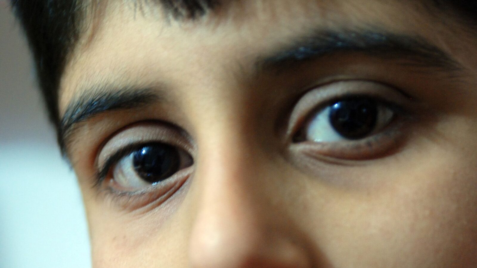 ⚕️ Salud: Un niño sangraba por ojos y oídos