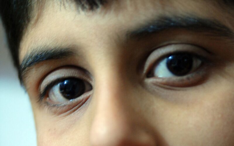 ⚕️ Salud: Un niño sangraba por ojos y oídos