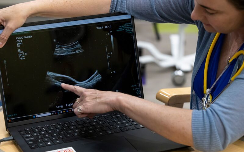 Salud: el PCOS pasa a llamarse PMOS