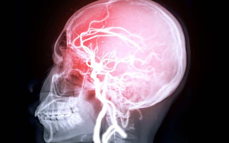 Neuro: El corazón débil deja huellas en la memoria