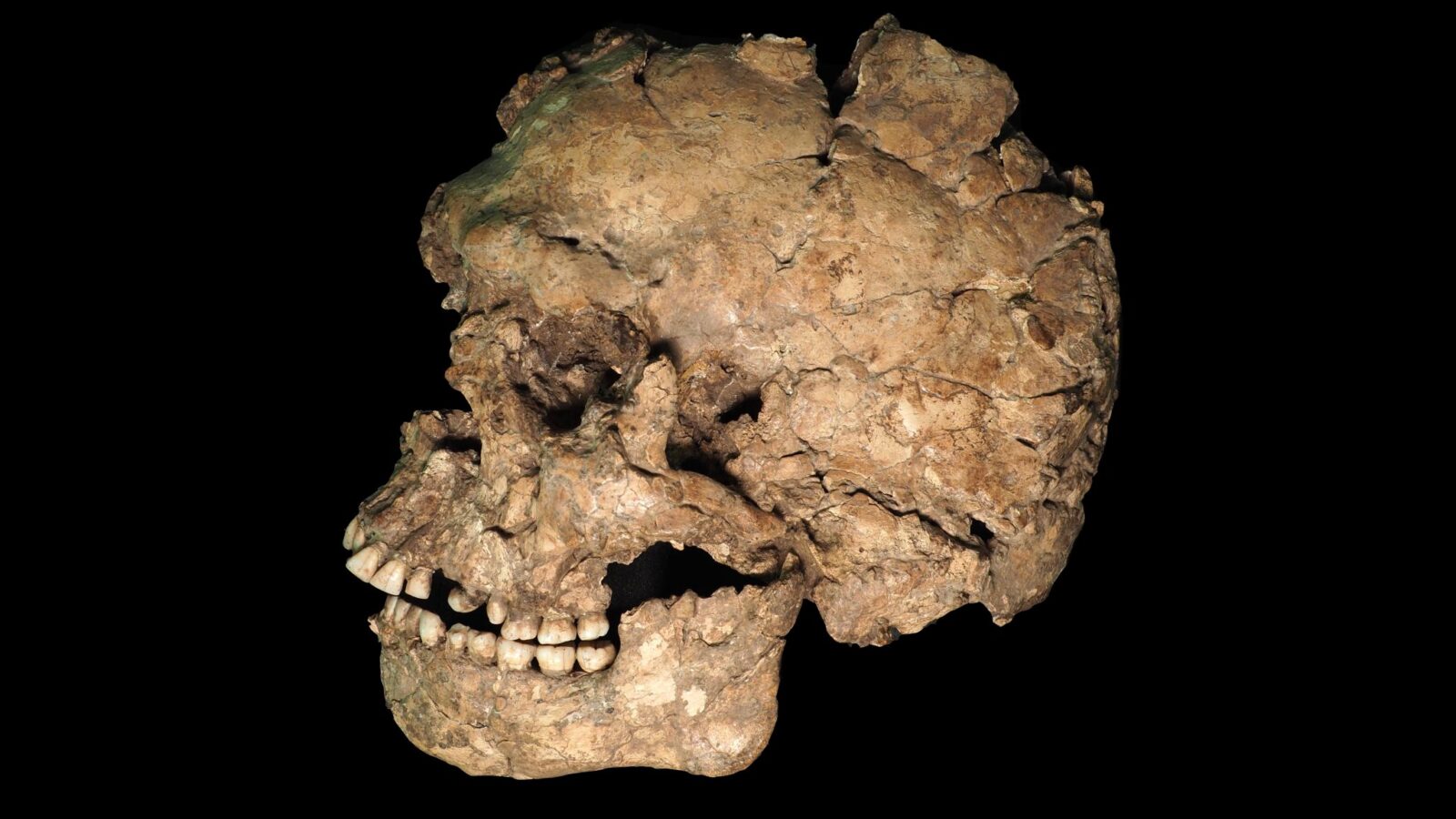 Paleo: Un corte en la cara hace 100 000 años