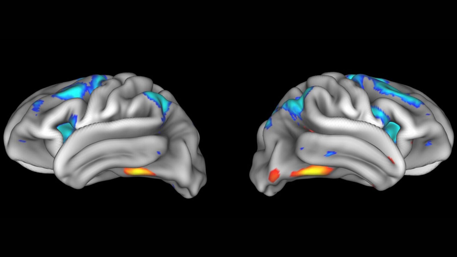 Neurociencia: Muchos hallazgos no se replican