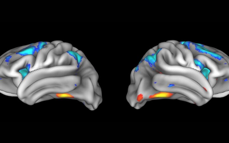 Neurociencia: Muchos hallazgos no se replican