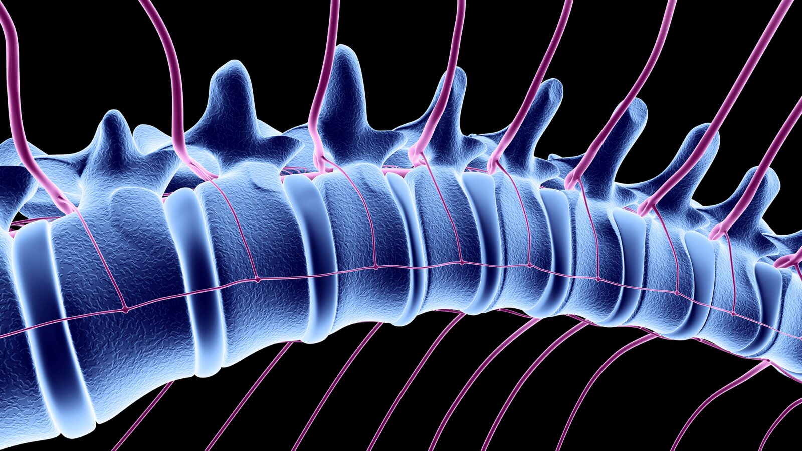 Salud: Un raro «ictus medular» en una niña