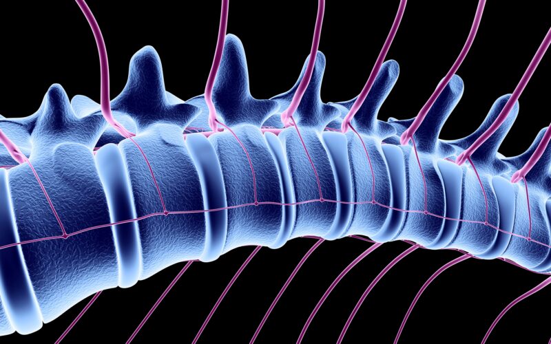 Salud: Un raro «ictus medular» en una niña