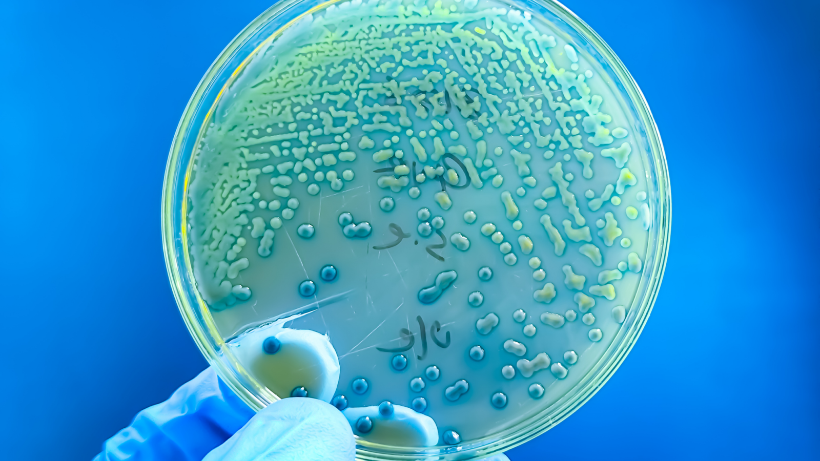 Salud: Aumenta la resistencia en infecciones infantiles