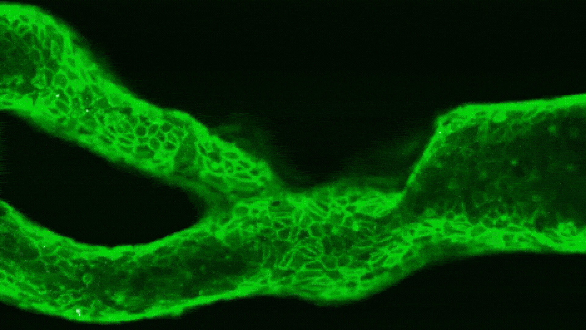 Salud: Miniarterias para estudiar el riesgo de ictus