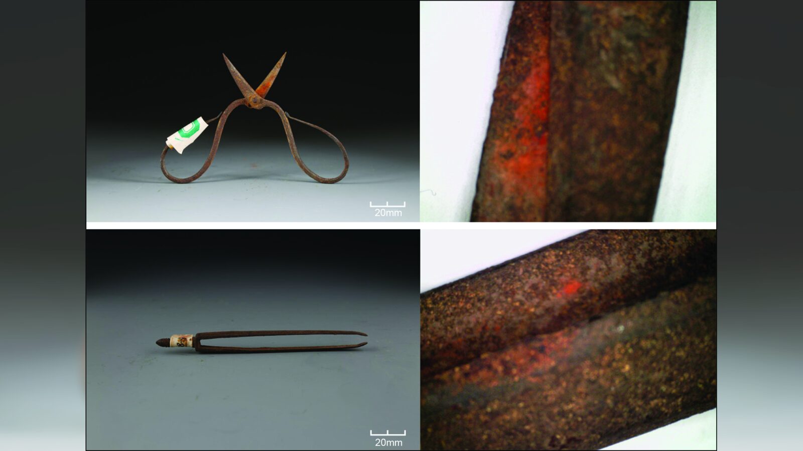 ⚕️ Medicina: Anestesia tóxica en cirugía Ming