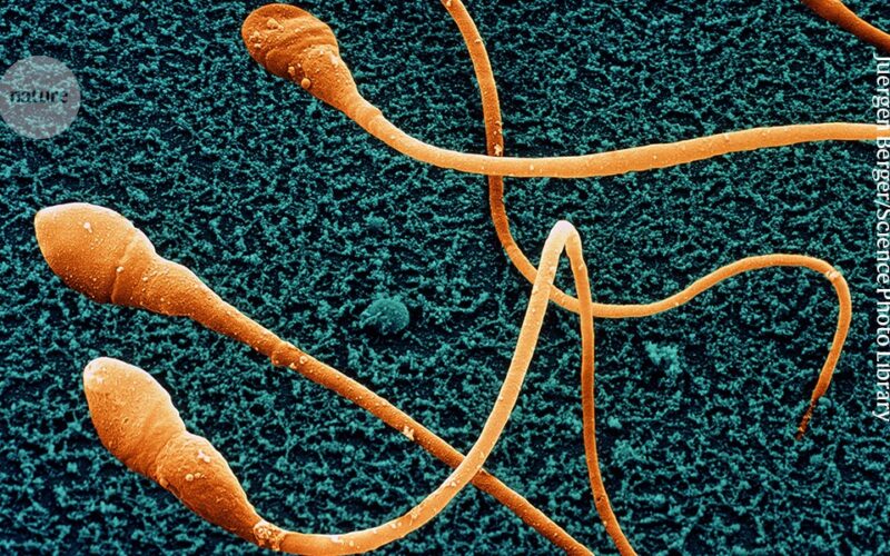 Medicina: Espermatozoides humanos de laboratorio, aún inmaduros