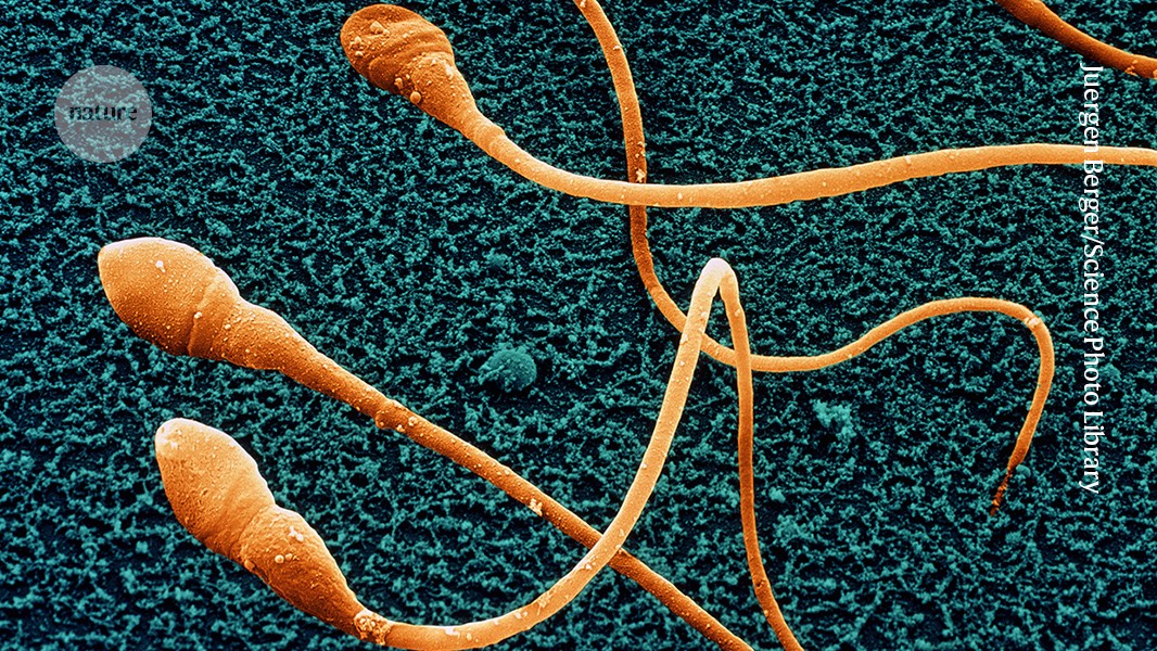 Medicina: Espermatozoides humanos de laboratorio, aún inmaduros