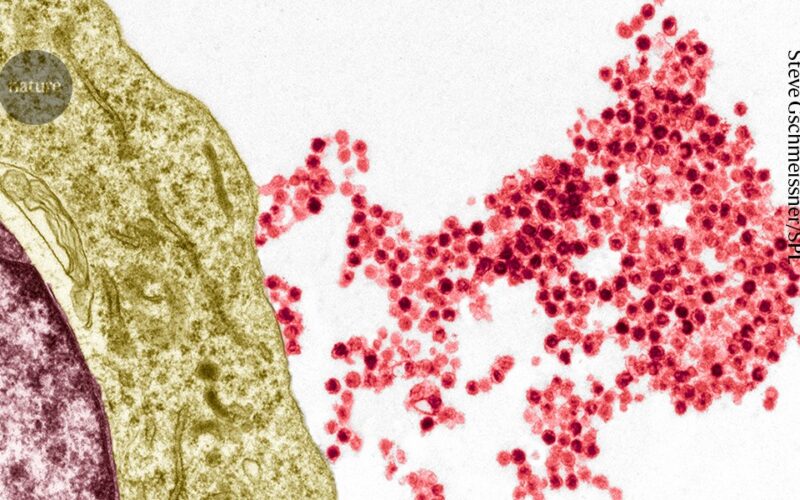 Medicina: Virus común y esclerosis múltiple