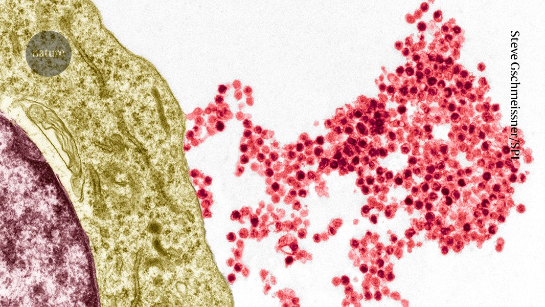 Medicina: Virus común y esclerosis múltiple