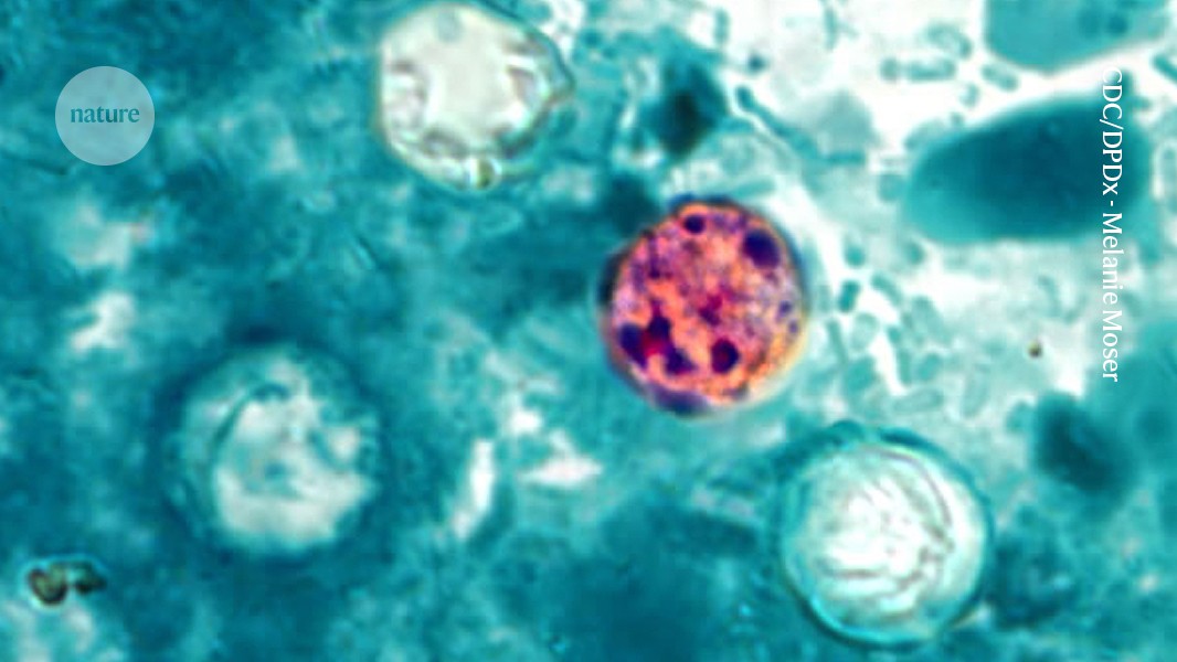 Salud: Cyclospora golpea comidas de verano en EE. UU.