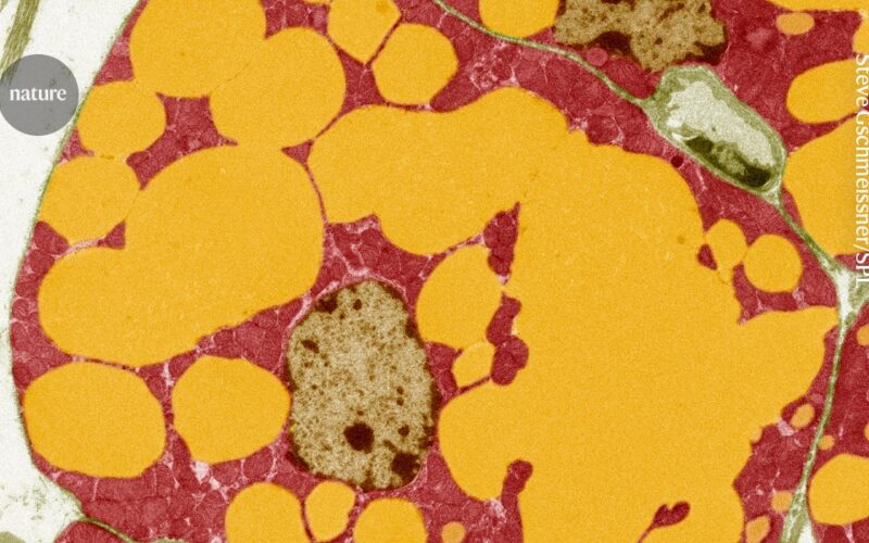 Genética: Variantes de FNIP1 ligadas a menos grasa abdominal