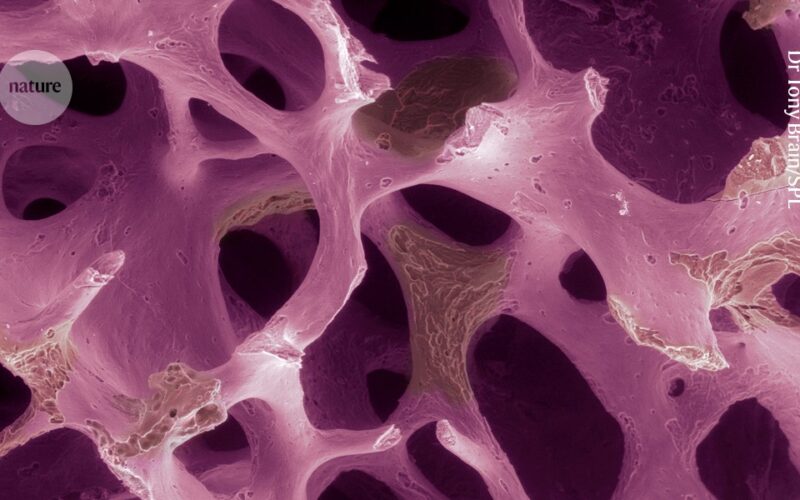 Salud: células modificadas frenan las fracturas en osteoporosis