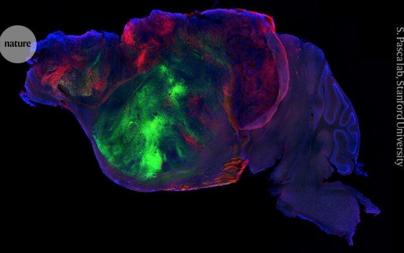 Neuro: Tejido cerebral humano ocupa espacio libre en ratones