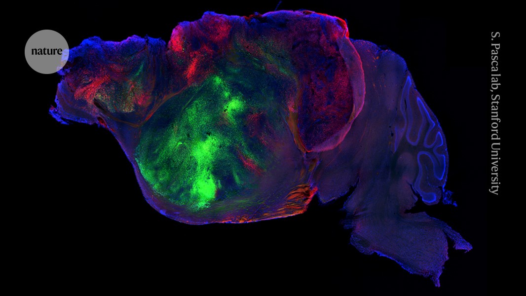 Neuro: Tejido cerebral humano ocupa espacio libre en ratones