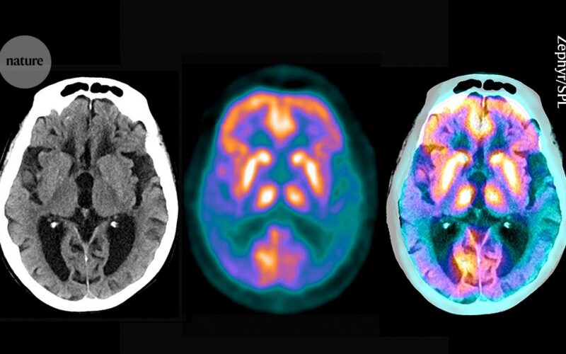Neuro: Un atlas revela microproteínas ocultas del cerebro