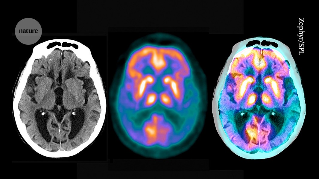 Neuro: Un atlas revela microproteínas ocultas del cerebro