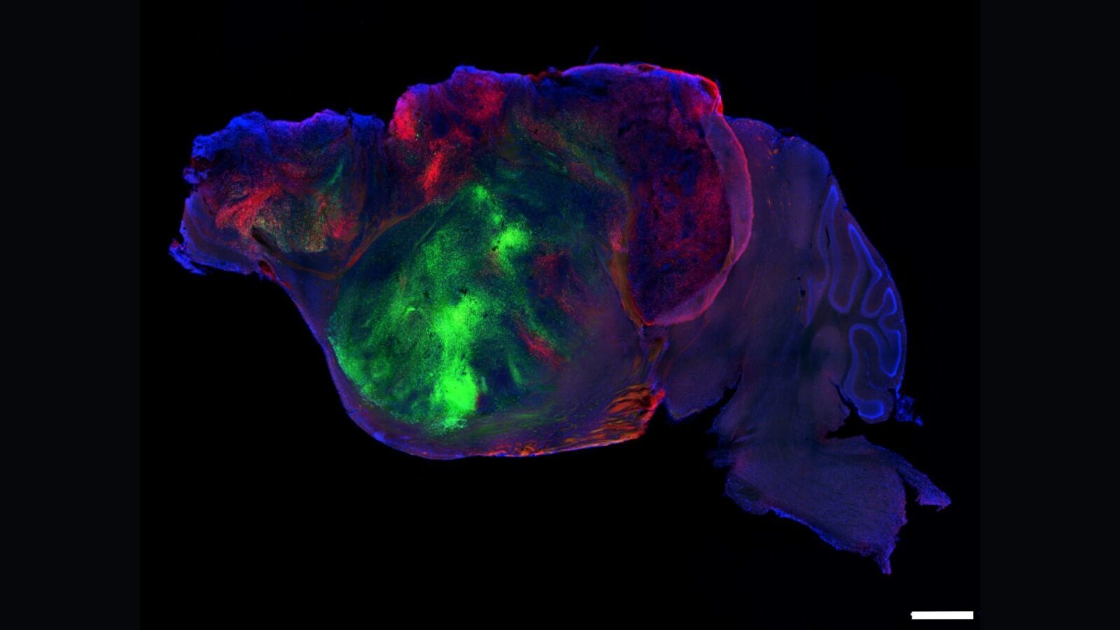 Neuro: Tejido cerebral humano crece en ratones con corteza reducida