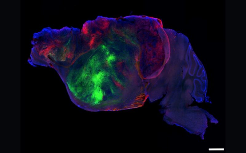 Neuro: Tejido cerebral humano crece en ratones con corteza reducida