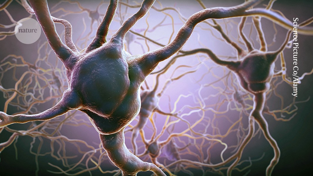 Neuro: Dos zonas cerebrales compiten al decidir qué arriesgar