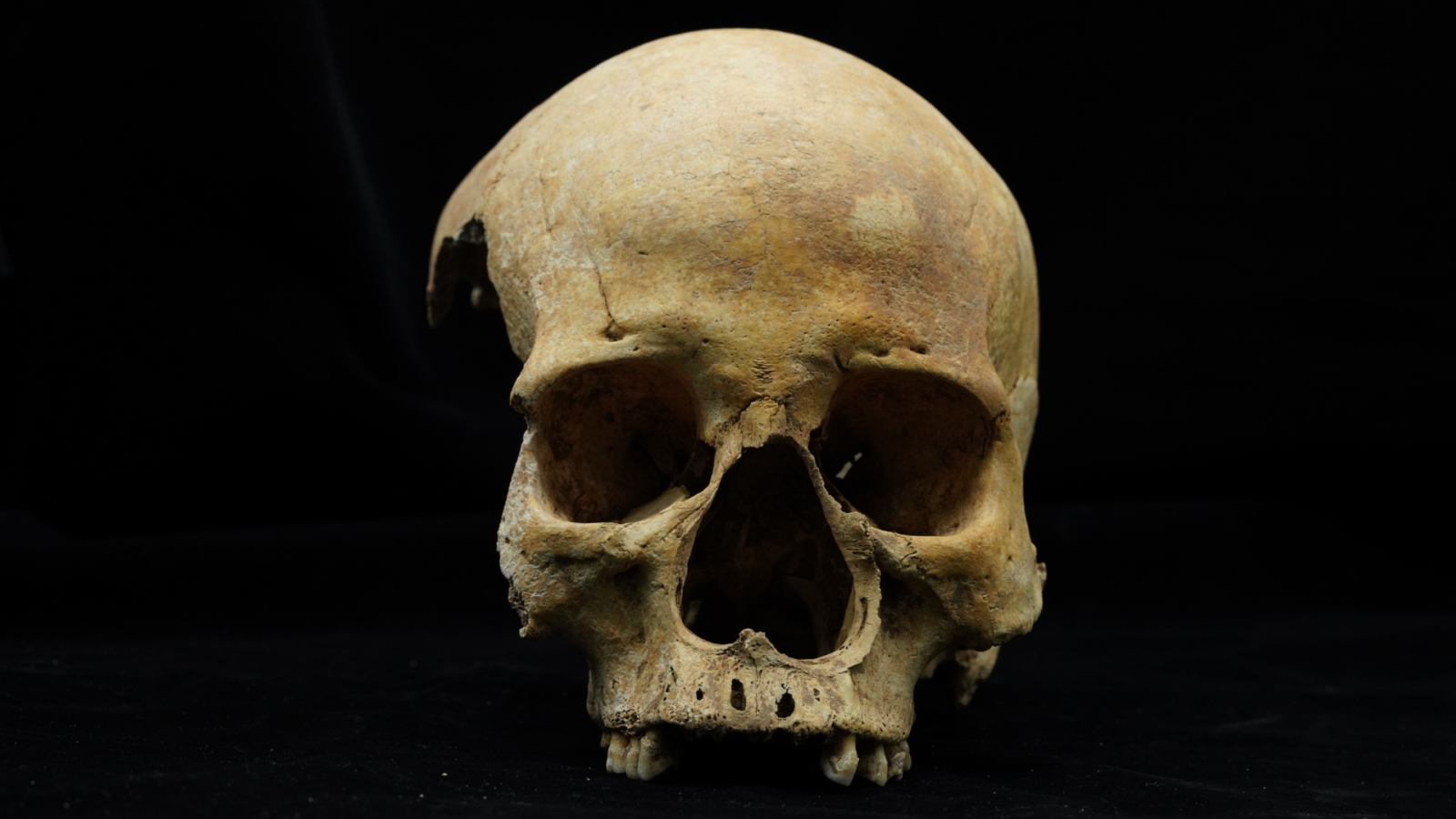 Arqueología: le cortaron la nariz en la China del siglo XIV
