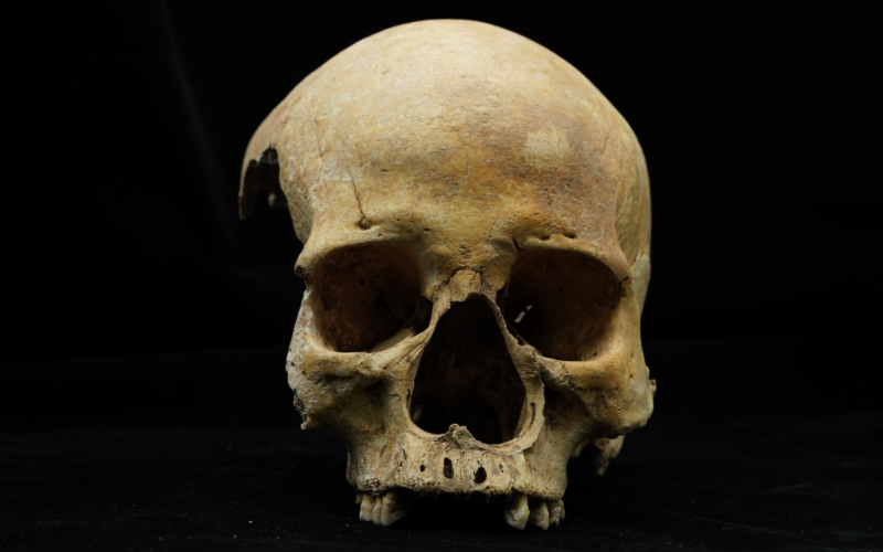 Arqueología: le cortaron la nariz en la China del siglo XIV