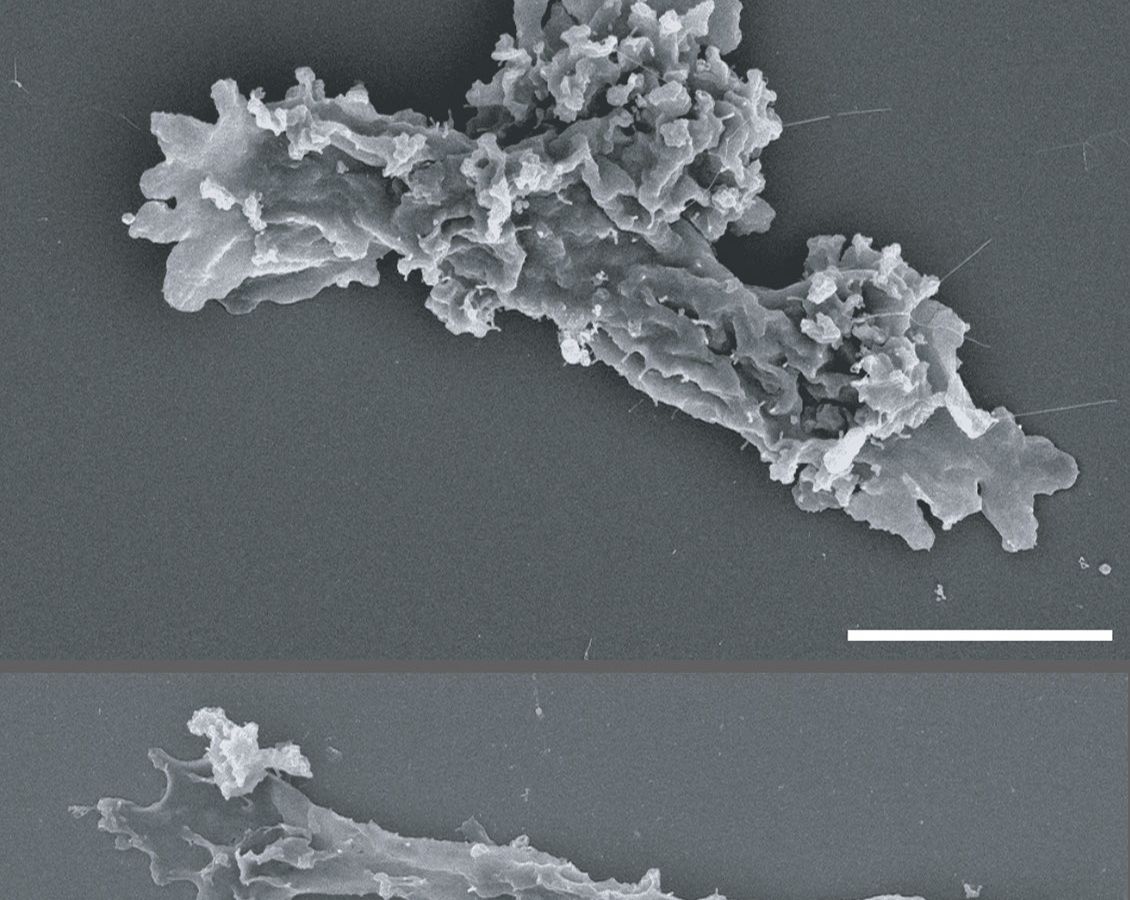 Biología: Una ameba que se divide a 63 °C