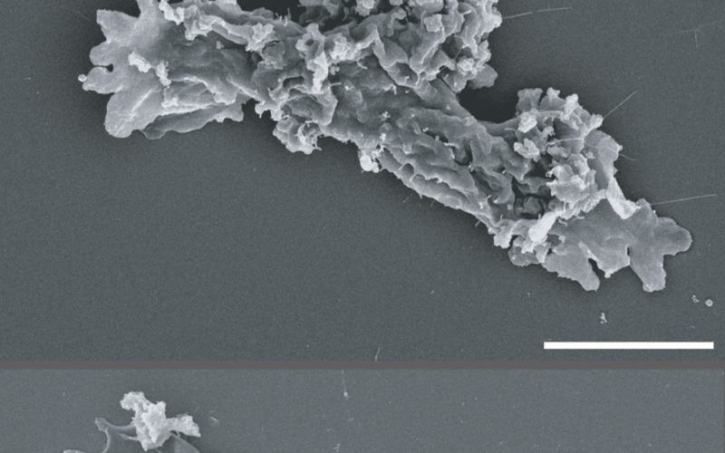 Biología: Una ameba que se reproduce a 63 °C