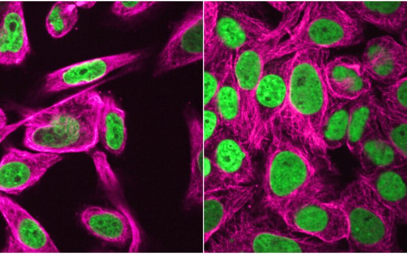 Genética: El genoma resiste un día de microgravedad simulada