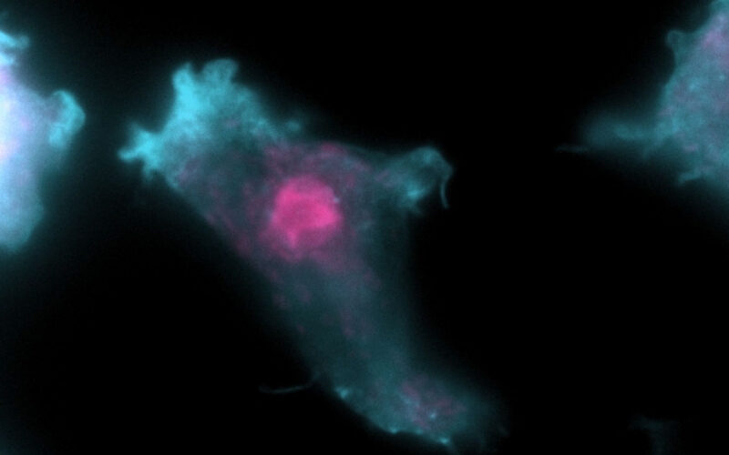 Biología: Cómo avanzan las parientes de la ameba comecerebros