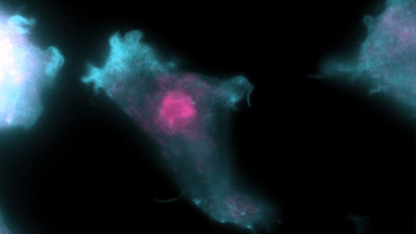Biología: Cómo avanzan las parientes de la ameba comecerebros