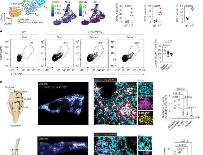 Neuro: El cráneo también vigila al cerebro