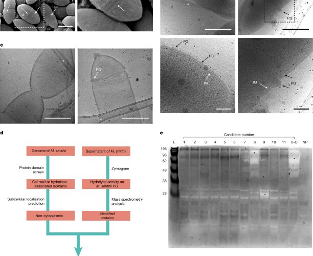 Microbiología: Una enzima reescribe la pared de las arqueas intestinales