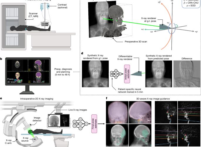 Tecnología: Una IA alinea radiografías con imágenes 3D