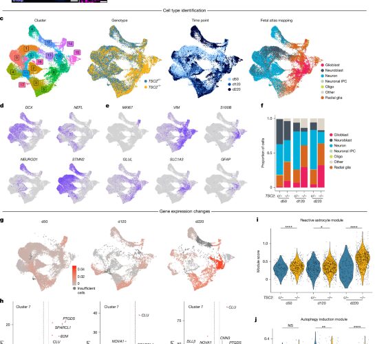 Neuro: Los astrocitos podrían impulsar la esclerosis tuberosa