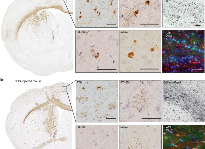 Neuro: La tau de ratón copia estructuras humanas