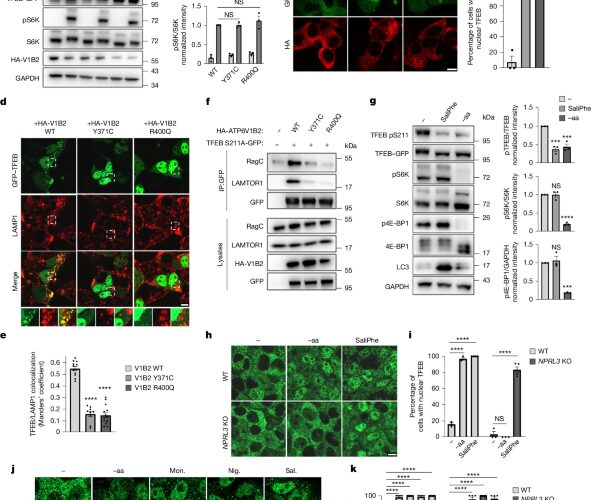 Biología: Una vía conecta estrés lisosomal y linfoma