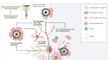 Neuro: Proponen un alzhéimer por fases y umbrales