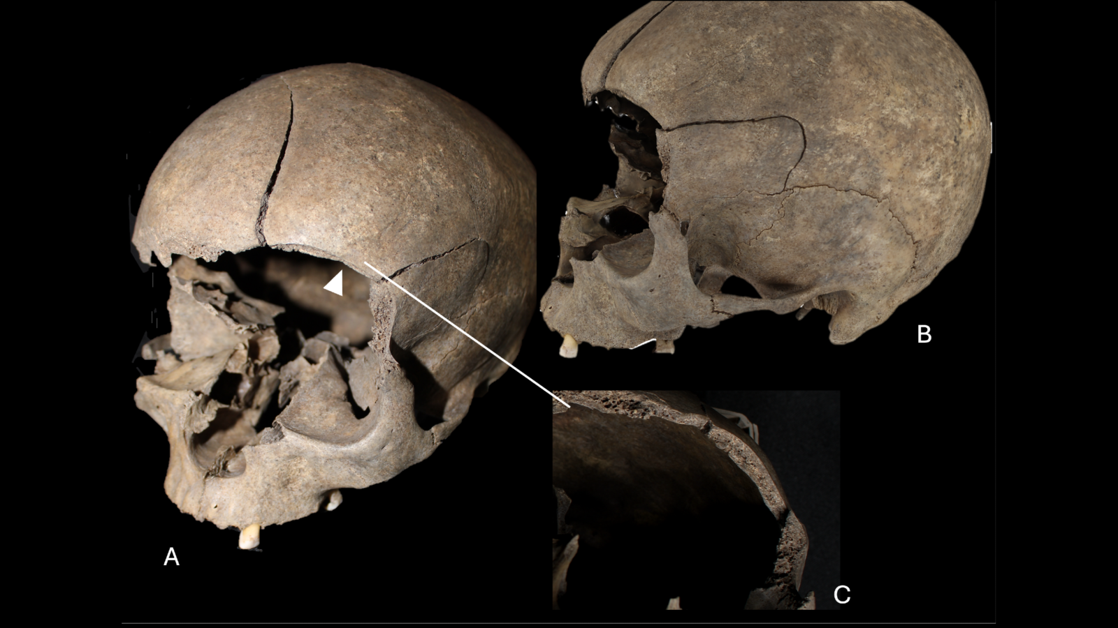 Arqueología: Un cráneo infantil en el suelo de una casa
