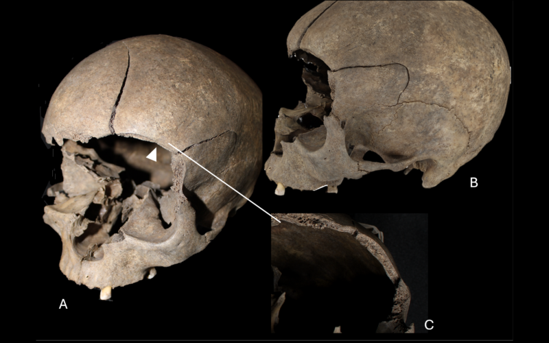 Arqueología: Un cráneo infantil en el suelo de una casa