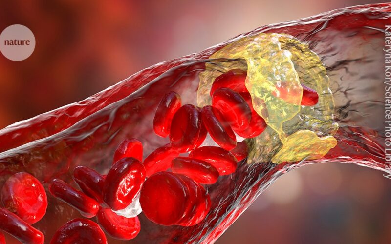 Salud: Una molécula intestinal reduce placas arteriales en ratones